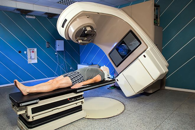 IGRT (Image-Guided Radiation Therapy)